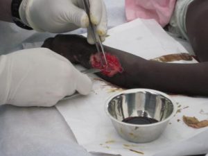 Dr. David in Surgery in Haiti